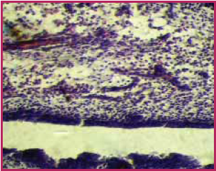 Гистоструктура клоакальной сумки 15-суточных куриных эмбрионов контрольной группы. Увеличение 15х8. Окраска гематоксилин-эозином