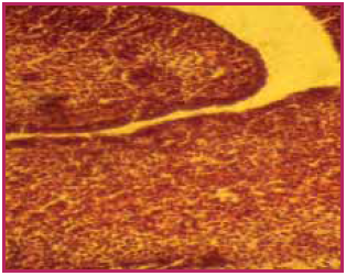 Гистоструктура клоакальной сумки 15-суточных куриных эмбрионов опытной группы. Увеличение 15х8. Окраска гематоксилин-эозином